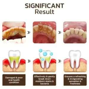 SmileFitPro™ Niacinamide Whitening Toothpaste