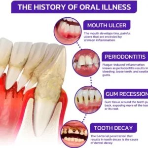 🇬🇧👨🏼‍⚕️Rolimey® VioGloss Bee Venom Dental Therapy Oral Power🦷