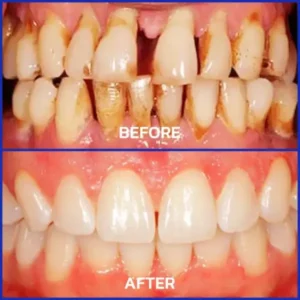 ❤️Rolimey® VioGloss Bienengift-Zahntherapie Oral Power 🦷 (🇩🇪 BZÄK Zugelassen)
