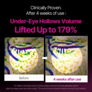 ✨ LAST DAY BUY 1 GET 1 FREE✨Cemenrete Calcium Dark Spot Eye Cream | Dark Circle, Anti-aging, Sagging, Elasticity