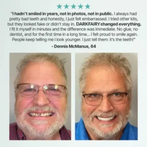 DarkFairy™ Custom-Fit Dentures — Designed for Comfort and a Natural-Looking Smile