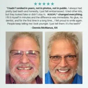 -Ends Today: 70% OFF!🦷DarkFairy™ Custom-Fit Full Functional Dentures Make you more confident