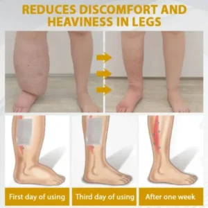 ATTDX® MicroSting Bee Vein Ease Patches