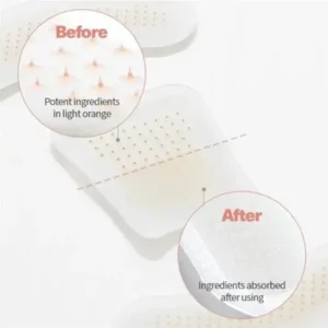 ATTDX® MicroSting Bee Vein Ease Patches