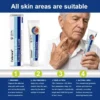 ✨😍Celsiora® Targeted Skin Tag & Wart Removal Cream – Time-Released Phyto-Exfoliant (12% Celandine ) & Bio-Active Terpene Viral-Inhibitor (8% Thuja)