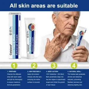 ✨😍Celsiora® Targeted Skin Tag & Wart Removal Cream – Time-Released Phyto-Exfoliant (12% Celandine ) & Bio-Active Terpene Viral-Inhibitor (8% Thuja)