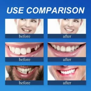 KLENIMORE™ Custom-Fit Dentures