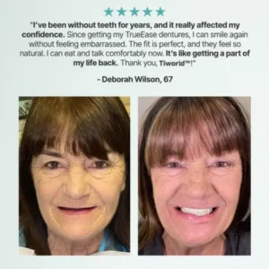 Tiworld™ Custom-Fit Full Functional Dentures