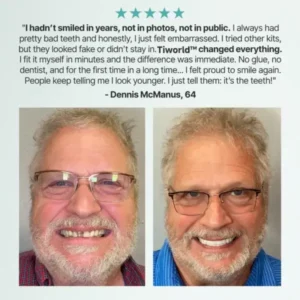 Tiworld™ Custom-Fit Full Functional Dentures