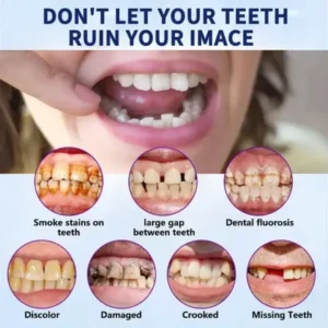 Vaxflite™Advanced Full Denture Set
