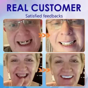 Vaxflite™Advanced Full Denture Set